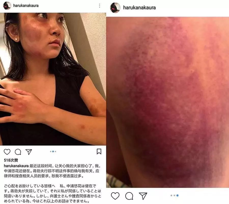 蒋劲夫承认家暴！反家暴，我们真的需要看看国外怎么做...