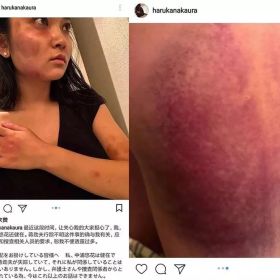 蒋劲夫承认家暴！反家暴，我们真的需要看看国外怎么做...