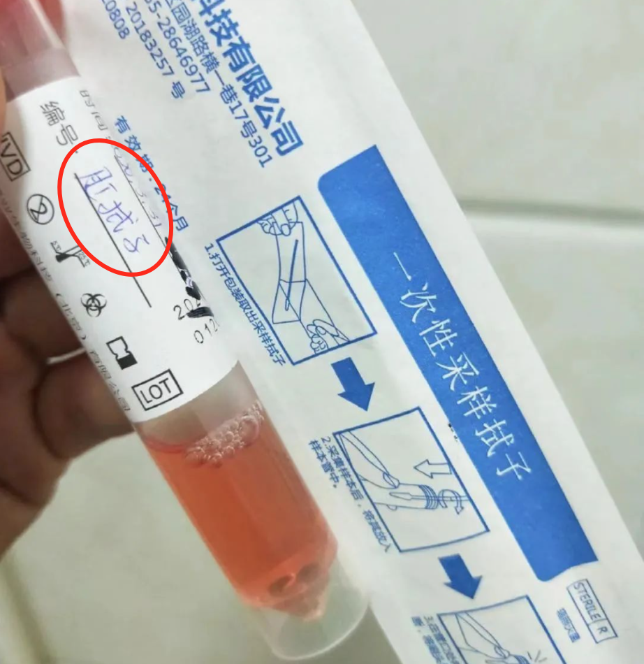 中国新增肛拭子采样,华人回国要被捅"菊花":伤害性不大,"侮辱性"极强!